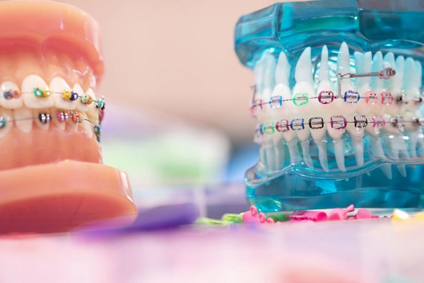 Two Sets of Different Colored Dental Casts Placed On A White Table In A Dental Clinic.